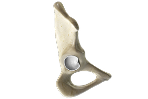 Labral Tears of the Hip Icon