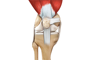 Quadriceps Tendon Repair Icon
