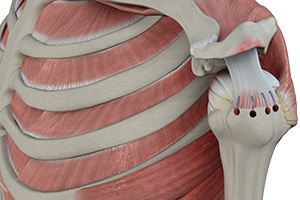 Rotator Cuff Repair Icon