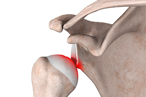 Shoulder Stabilization Icon