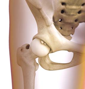 Hip Synovitis pic