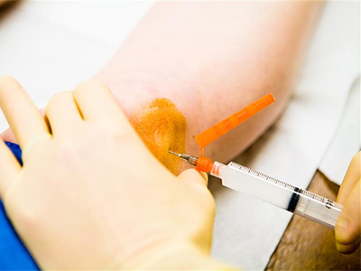Cortisone Injection - Educational Photo