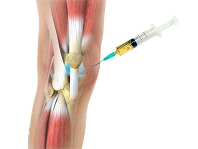 Peripheral Joint Injections - Educational Photo
