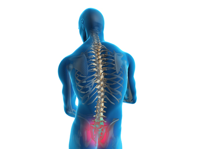 Sacroiliac Joint Dysfunction - Educational Photo