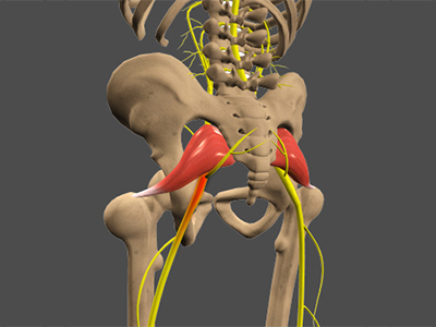 Sciatica - Educational Photo