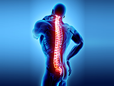 Spondyloarthropathies - Educational Photo