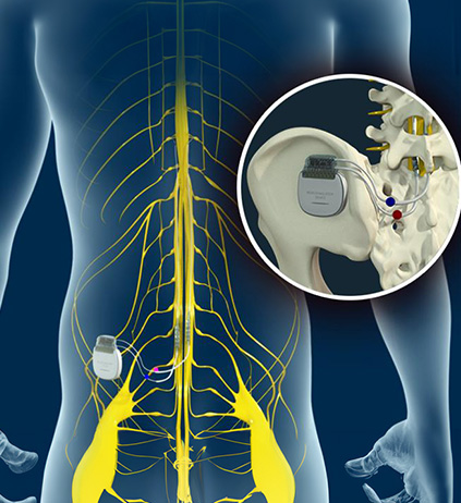Advanced Procedures - Educational Photo