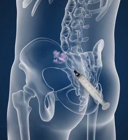 Procedures - Educational Photo