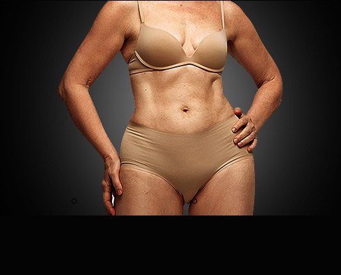 Picture of Body Procedures