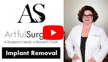 Picture of Star Implant Removal