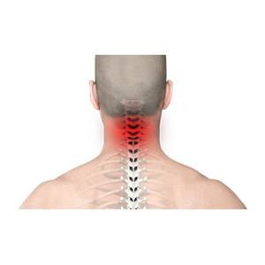 Neck and Back Injuries pic