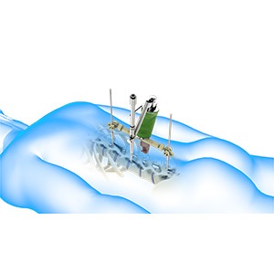 Robotic Spine Surgery pic