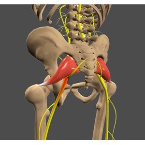 Sciatica pic