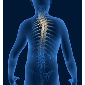 Spine Deformities pic