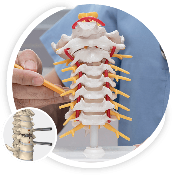 Artificial Cervical Disc Replacement Pic