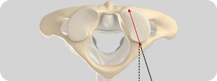 C1 lateral mass anatomy Pic