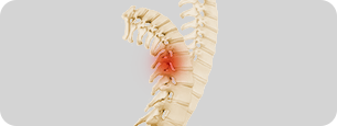 Pediatric Cervical Spine  Pic