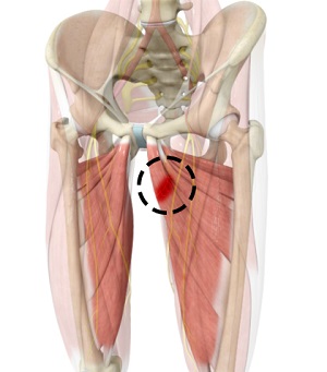 Hip Adductor Injuries pic