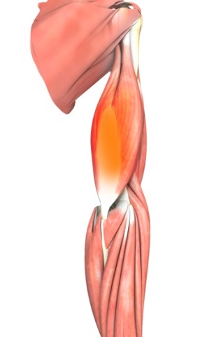 Triceps Tendonitis