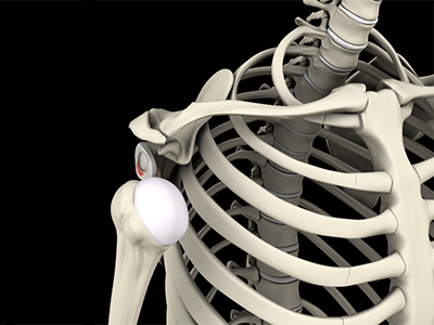 Shoulder Instability