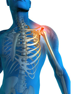 Shoulder Pain