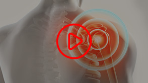 Patient Educational Videos
