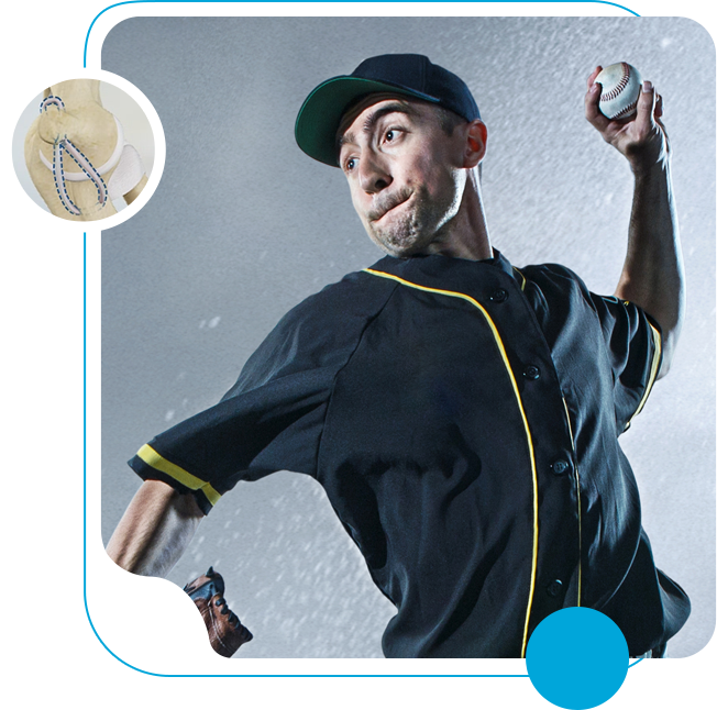 UCL Repair for Enhanced Recovery Icon