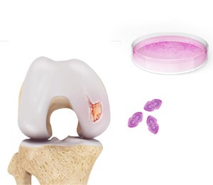 Orthobiologics for the Knee  pic