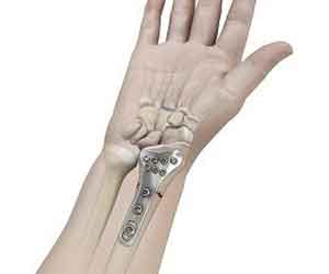 Pediatric Orthopedic Surgery pic