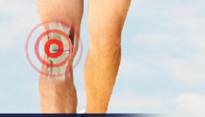 Patellofemoral Pain Syndrome pic