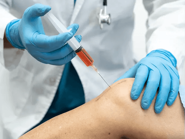 Non-surgical Treatment