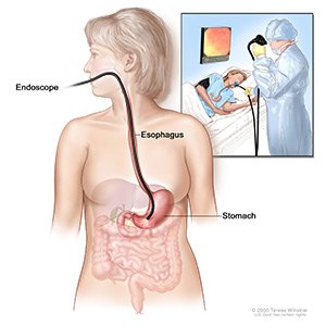 Picture of endoscopy