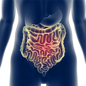 Picture of Inflammatory Bowel Disease