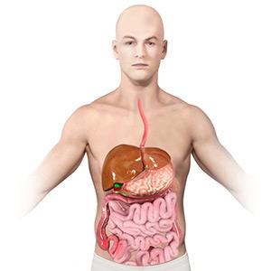 Picture of Irritable Bowel Syndrome