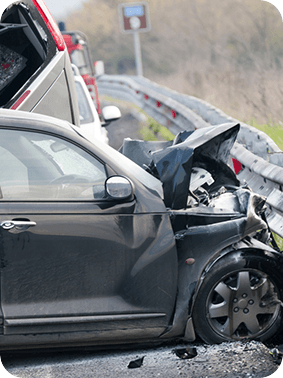 Automobile Injury Pic