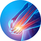 Elbow Pain Image