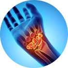 Hand & Wrist Pain Image