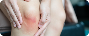 Post-Surgical Image