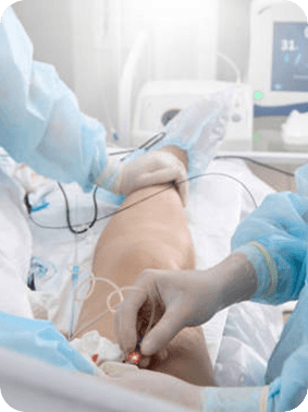 Radiofrequency Ablation Pic