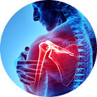 Shoulder Pain Image