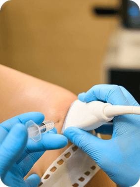 Ultrasound Guided Injections Pic