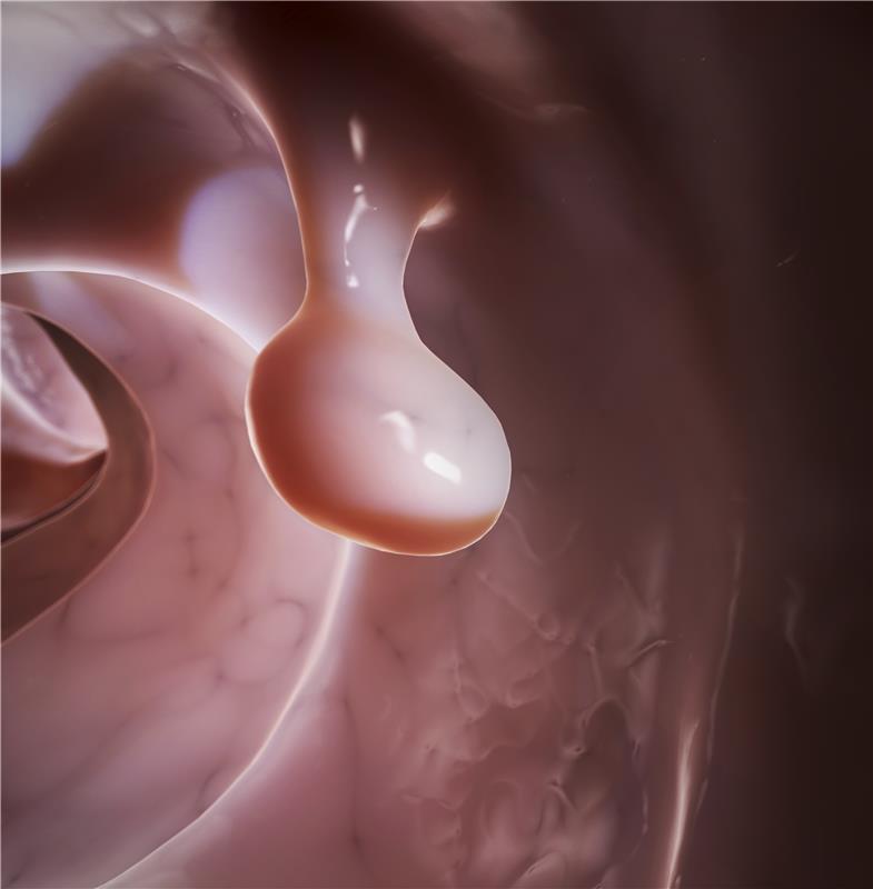 Colorectal Polyps Images