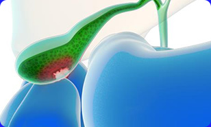 Gallbladder Surgery Icon