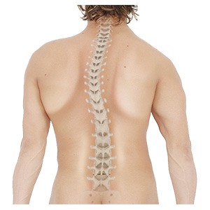 Scoliosis pic