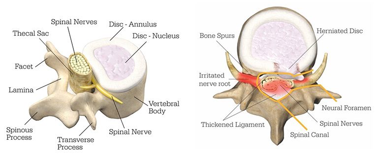 Picture of Mako Spine Anatomy with Labels