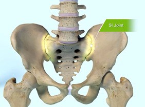 Sacroiliac Joint (SI Joint) Anatomy Pic