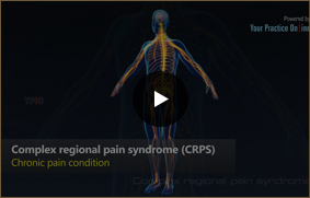 Complex Regional Pain Syndrome - Video Picture