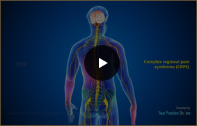 Dorsal Root Ganglion Stimulation - Video Picture