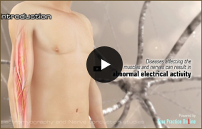 Electromygraphy and Nerve Conduction Studies - Video Picture