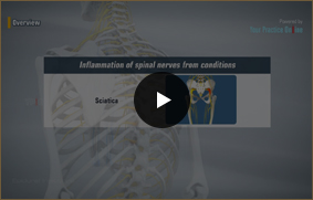 Epidural Injection - Video Picture
